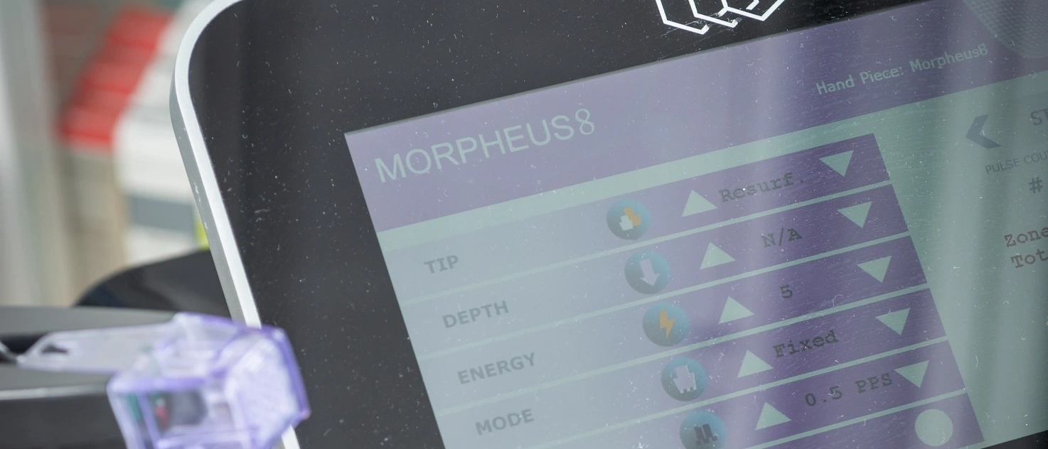 Morpheus8 Gerät mit Einstellungen für die Radiofrequenztherapie