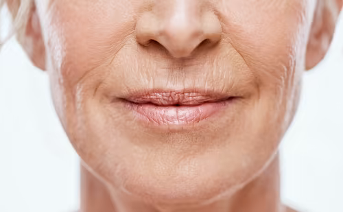 Falten um Augen und Mund