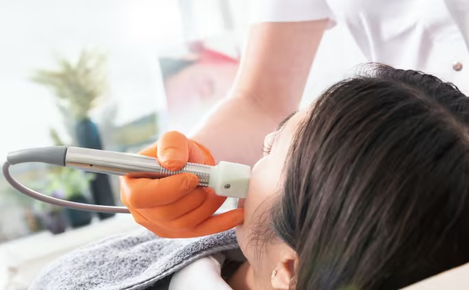 Fraktionierte Radiofrequenz Behandlung